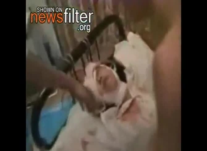 Video :Lady getting tortured and amputated in brutal porn